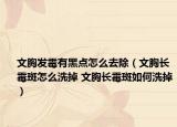 文胸發(fā)霉有黑點(diǎn)怎么去除（文胸長(zhǎng)霉斑怎么洗掉 文胸長(zhǎng)霉斑如何洗掉）