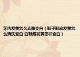 牙齒發(fā)黃怎么去除變白（鞋子鞋底發(fā)黃怎么清洗變白 白鞋底發(fā)黃怎樣變白）
