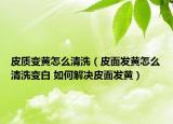 皮質(zhì)變黃怎么清洗（皮面發(fā)黃怎么清洗變白 如何解決皮面發(fā)黃）