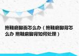 拖鞋磨腳面怎么辦（拖鞋磨腳背怎么辦 拖鞋磨腳背如何處理）