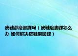 皮鞋都磨腳踝嗎（皮鞋磨腳踝怎么辦 如何解決皮鞋磨腳踝）