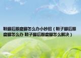 鞋腳后跟磨腳怎么辦小妙招（鞋子腳后跟磨腳怎么辦 鞋子腳后跟磨腳怎么解決）