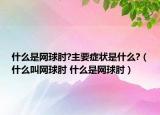 什么是網(wǎng)球肘?主要癥狀是什么?（什么叫網(wǎng)球肘 什么是網(wǎng)球肘）