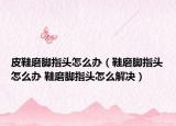 皮鞋磨腳指頭怎么辦（鞋磨腳指頭怎么辦 鞋磨腳指頭怎么解決）