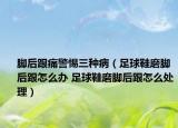 腳后跟痛警惕三種?。ㄗ闱蛐ツ_后跟怎么辦 足球鞋磨腳后跟怎么處理）