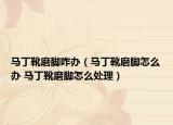 馬丁靴磨腳咋辦（馬丁靴磨腳怎么辦 馬丁靴磨腳怎么處理）