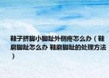 鞋子擠腳小腳趾外側疼怎么辦（鞋磨腳趾怎么辦 鞋磨腳趾的處理方法）