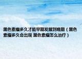 黑色素瘤多久才能早期發(fā)展到晚期（黑色素瘤多久會(huì)出現(xiàn) 黑色素瘤怎么治療）